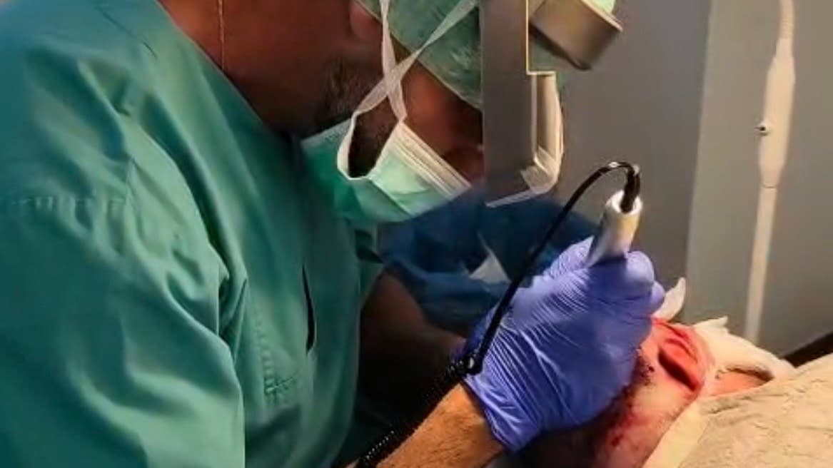 Hårtransplantation behandling